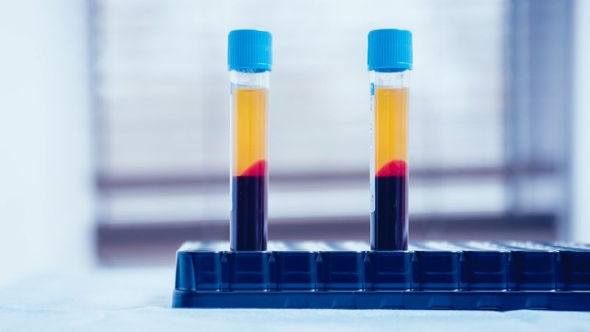 Primer tratamiento con plasma en Utah a una mujer con coronavirus