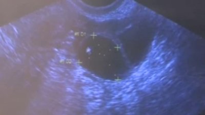 Utah se une a ley contra el aborto