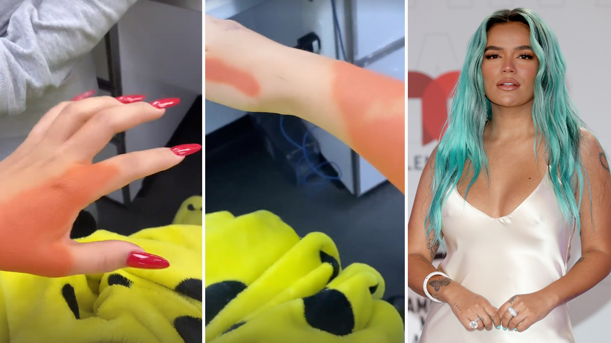 Karol G se quita sus tatuajes de Anuel AA – Telemundo Utah