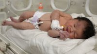 Bajo los escombros y con el cordón umbilical: la beba que venció a la muerte en Siria