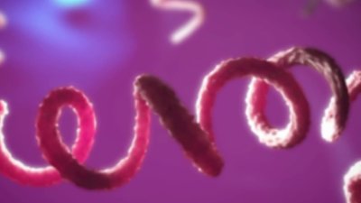 Reportan aumento alarmante de casos de sífilis en mujeres hispanas en el Condado de Salt Lake