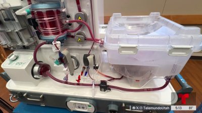 Llega a Utah nueva tecnología de última generación para salvar órganos