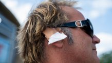 A delegate wears an imitation ear bandage during the Republican National Convention (RNC) outside the Fiserv Forum in Milwaukee, Wisconsin, US, on Wednesday, July 17, 2024. The RNC chairman warned against complacency when his party concludes its official nominating jamboree this week with polls predicting ex-President Donald Trump prevailing over President Joe Biden in the November election. Photographer: Vincent Alban/Bloomberg via Getty Images
