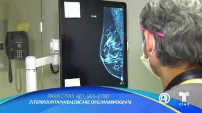 Mamografías móviles para las mujeres de Utah