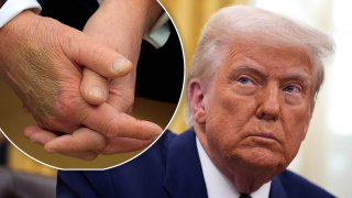 Donald Trump fue fotografiado con un hematoma en las manos el 24 de febrero de 2025, en la Casa Blanca.