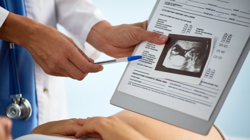 Sonogram of unborn baby in womb being shown and commented by doctor